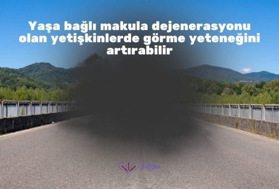 Yaşa bağlı makula dejenerasyonu olan yetişkinlerde görme yeteneğini artırabilir